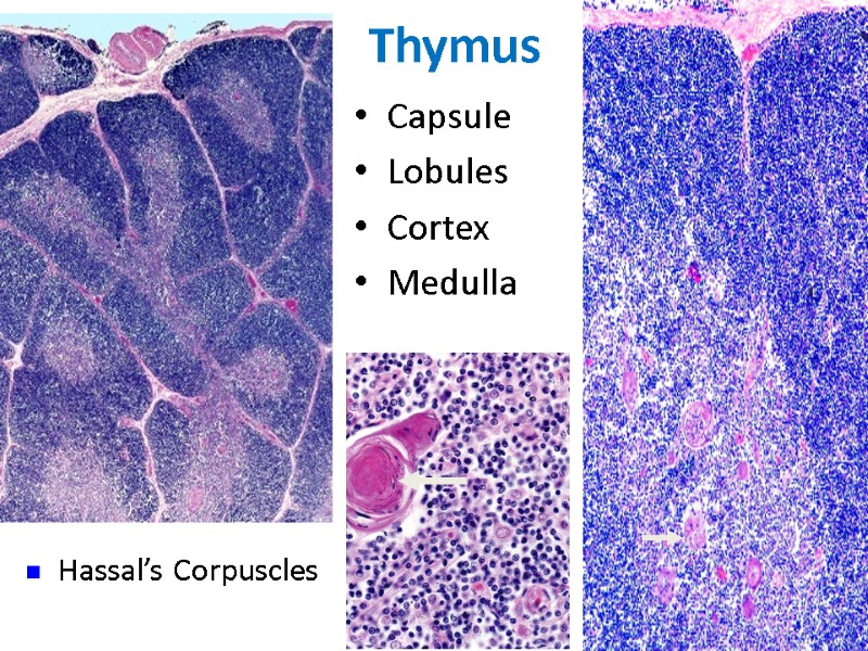 Thymus Capsule Lobules Cortex Medulla Hassal’s Corpuscles